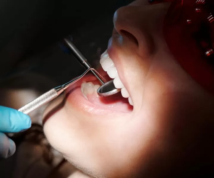 Dental Replacements Guide: Bridges vs. Implants for U.S. Patients