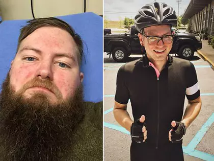 These 10 Before-And-After Photos Show What Happens When You Stop Drinking
