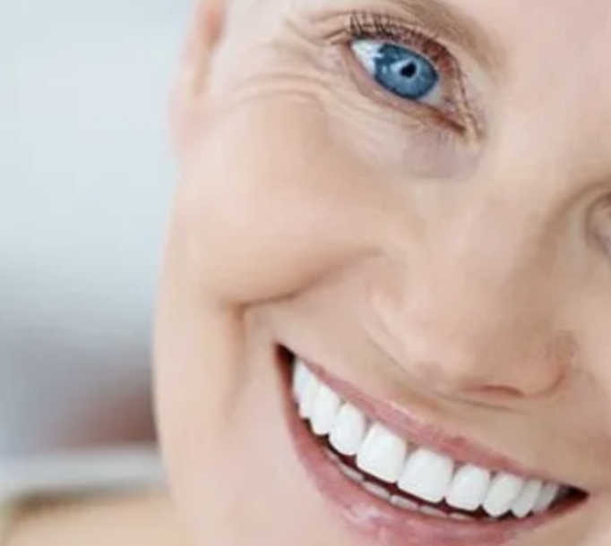 Unlocking the Secrets to a Perfect Smile with Dental Implants