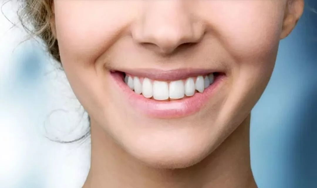 Unlocking the Secrets to a Perfect Smile with Dental Implants