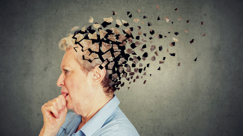 Understanding Alzheimer's: Navigating the Landscape of Memory Loss