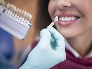 Detailed Explanation of the Entire Dental Implant Process