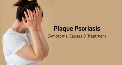 Comprehensive Guide to Plaque Psoriasis Treatments