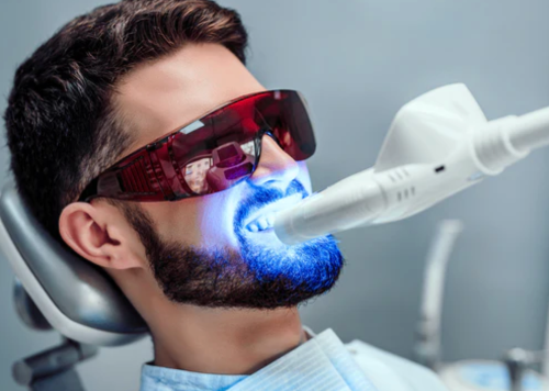 Teeth Whitening: A Comprehensive Guide to Achieving a Brighter Smile