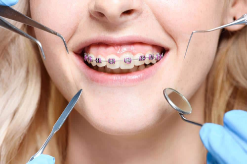 Transform Your Smile with Orthodontics: Achieving Straighter Teeth and Greater Confidence