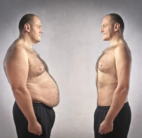 Non-Surgical-Fat-Removal:-How-SculpSure-Works