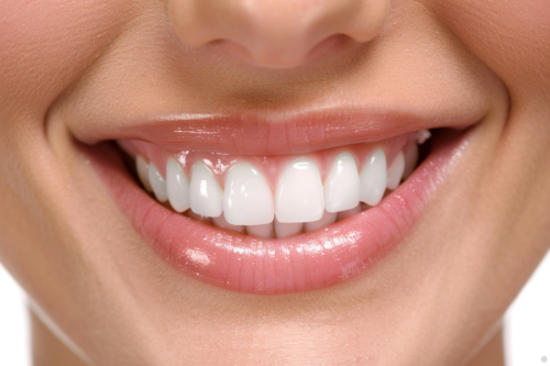 Brightening Smiles: Exploring the World of Teeth Whitening in Canada